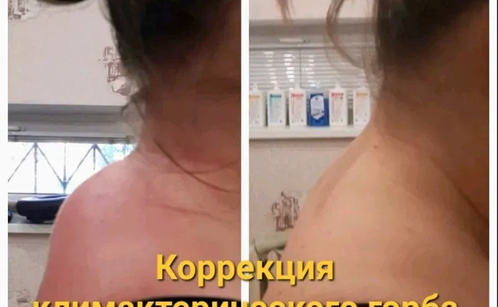 Професійний Лікувальний Масаж Спини. Висока якість, зручна локація (Лівий берег). Професійний Лікувальний Масаж Спини. Висока якість, зручна локація (Лівий берег).