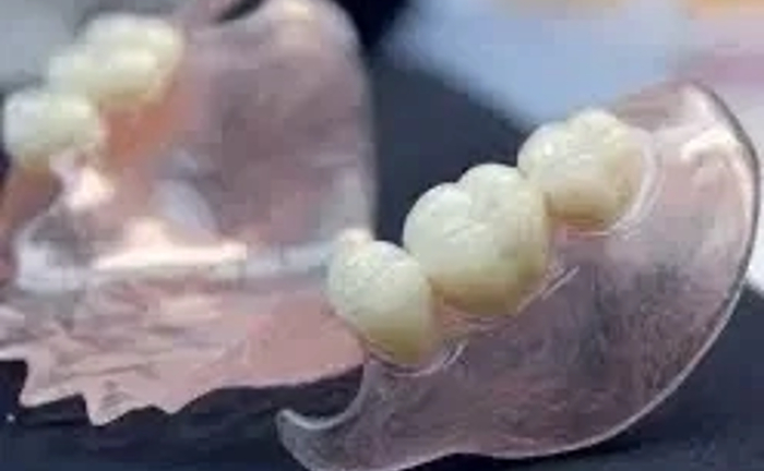 Пресовка-інжекція нейлонових протезів високої якості