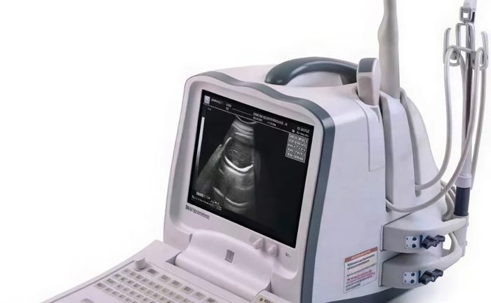 Mindray DP-6600 портативний УЗД апарат для діагностики