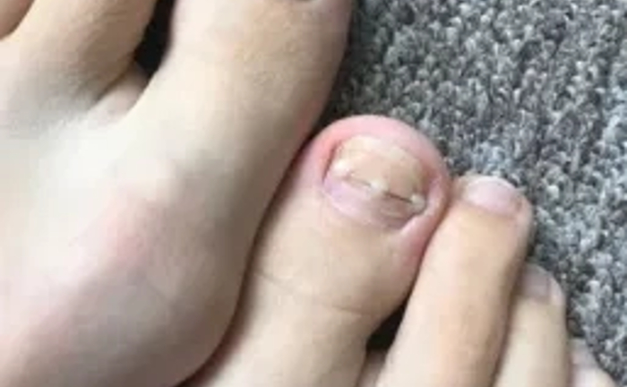 Педікюр подолог виізд