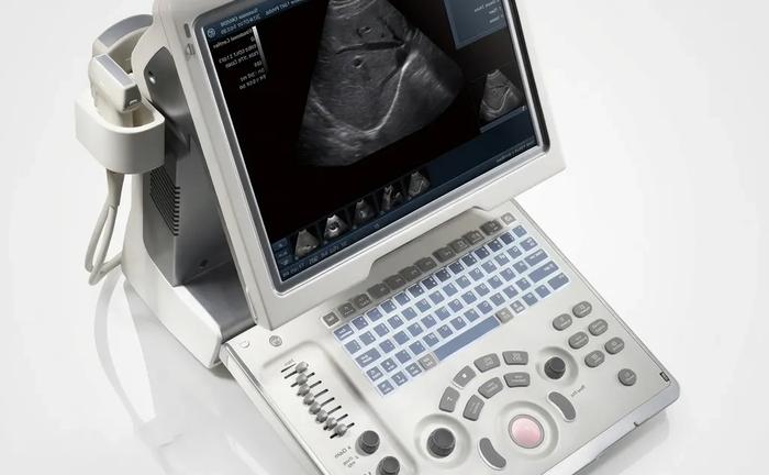 Діагностичний УЗД апарат Mindray DP10