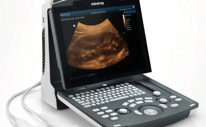 Апарат Mindray DP-10 для кабінету УЗД
