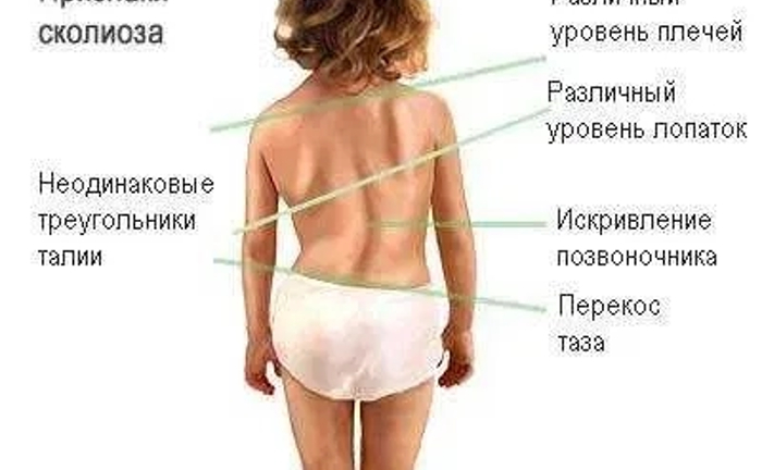 Лікування сколіозу, вальгусу, клишоногості, плоскостопості, порожнистої стопи. Лікування сколіозу, вальгусу, клишоногості, плоскостопості, порожнистої стопи.
