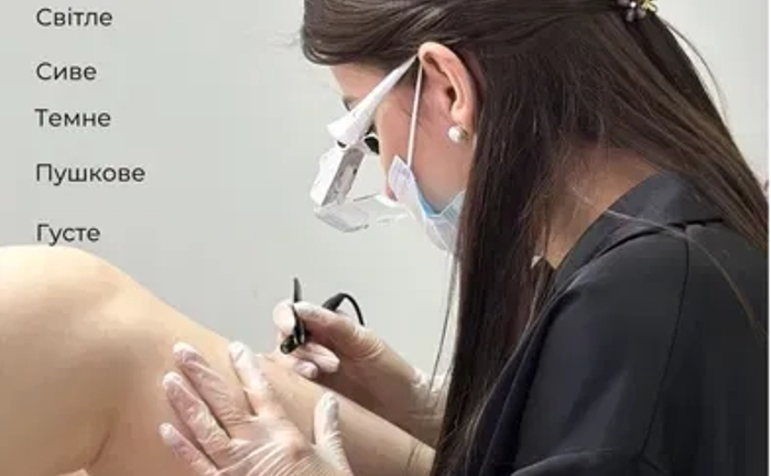 Лазерна епіляція, електроепіляція, электро, депиляция, депіляція