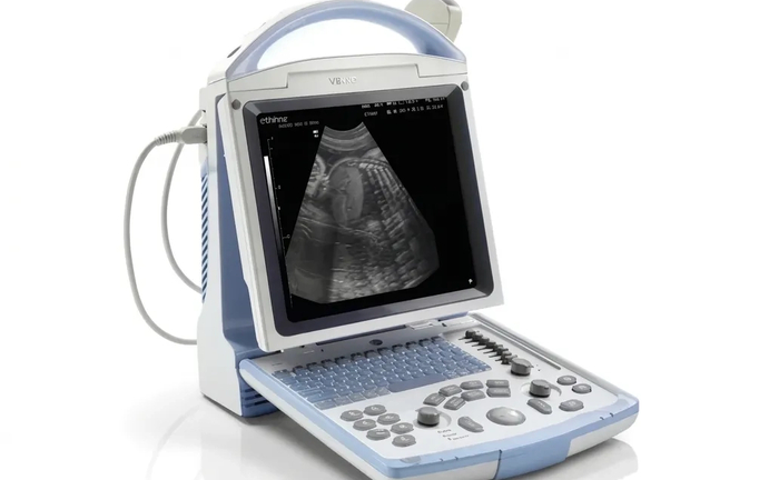 УЗД апарат - надійна діагностика