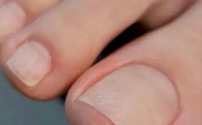 Курс «педикюр з основами подології»