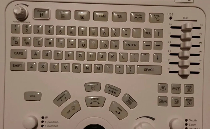 Ультразвуковий апарат Mindray Medical DigiPrince