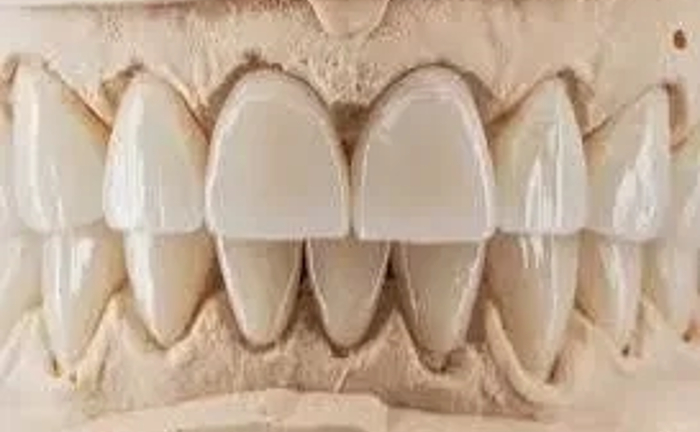 Зубний технік з досвідом: естетика, точність, результат