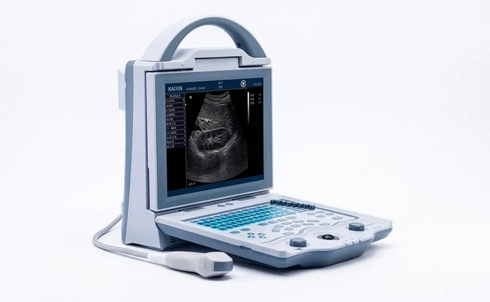 УЗД апарат Mindray DP10 для точної діагностики