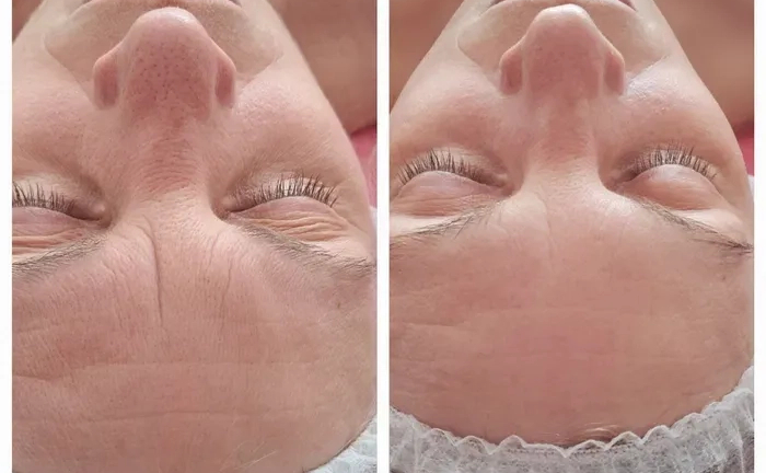 Косметолог. Массаж обличчя. Чистка обличчя. Пілінги. Косметолог. Массаж обличчя. Чистка обличчя. Пілінги.