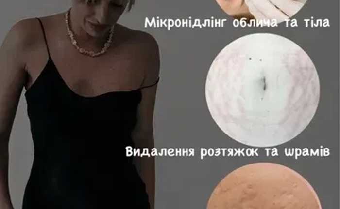 Микронидлинг обучение, Мікронідлінг навчання Микронидлинг обучение, Мікронідлінг навчання