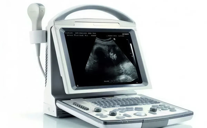 УЗД апарат Mindray DP-10 з індивідуальним налаштуванням робочих клавіш