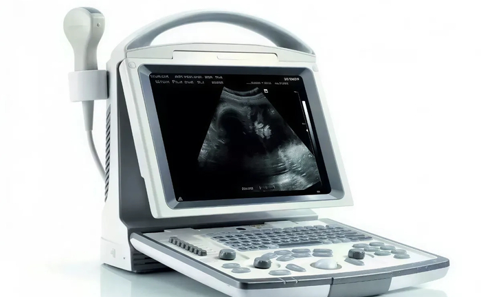 УЗД Mindray DP10— Надійність та мобільність діагностики
