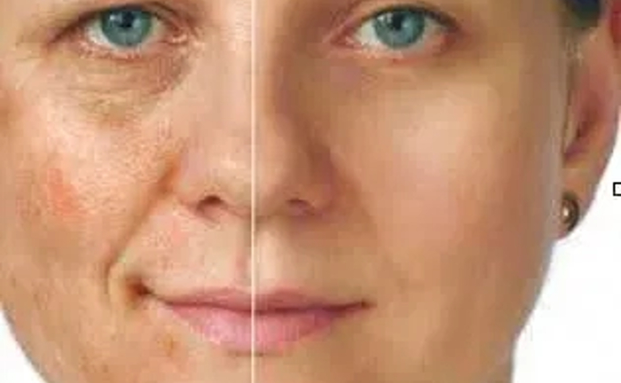 Хіджама для обличчя. Краса та догляд