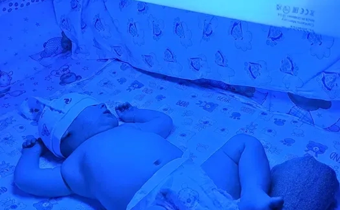 Лампа от желтухи, лампа від жовтяниці