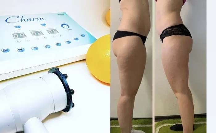 Масаж массаж Charm БМС тіла обличчя Шарм 400 грн.!