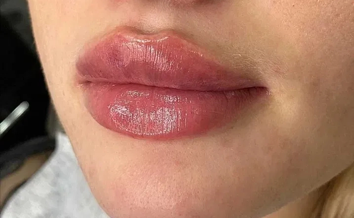 Акція! -30%! Збільшення губ у техніці плоский бант. Акція! -30%! Збільшення губ у техніці плоский бант.