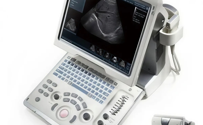 УЗД апарат Mindray DP10— Надійність та мобільність діагностики