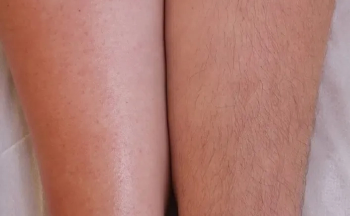 Шугаринг, воск! Троещина! Работаю профессиональными материалами Шугаринг, воск! Троещина! Работаю профессиональными материалами