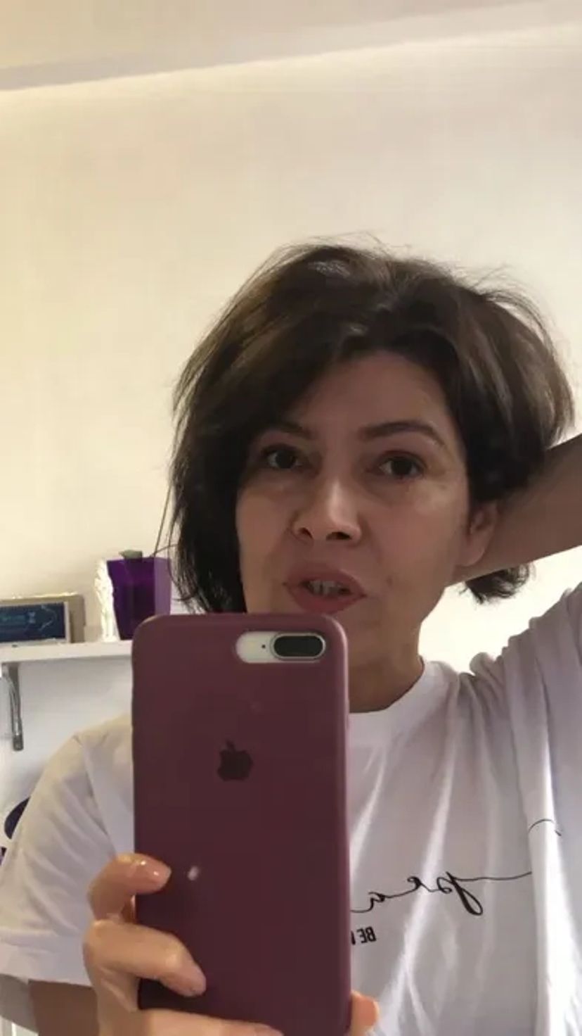 Електроепіляція. Косметолог. Навчання електроепіляції.