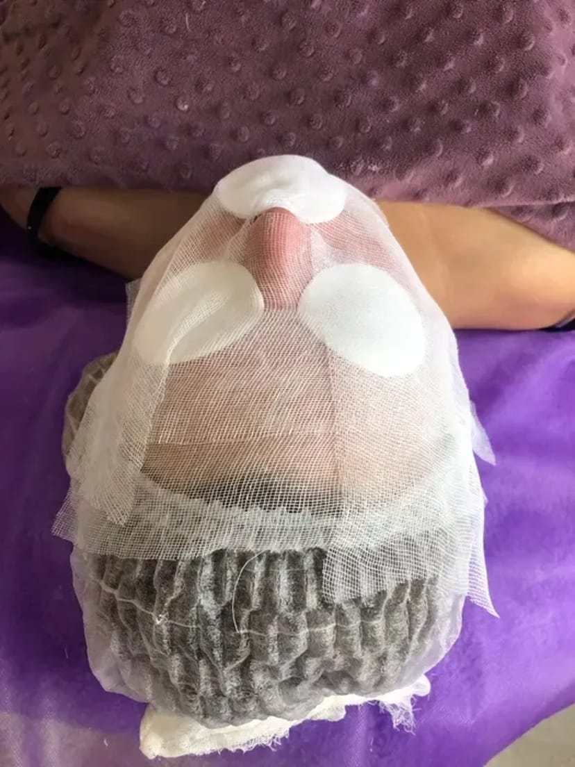 Електроепіляція. Косметолог. Навчання електроепіляції.