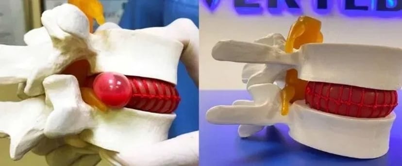 Остеопатія масаж