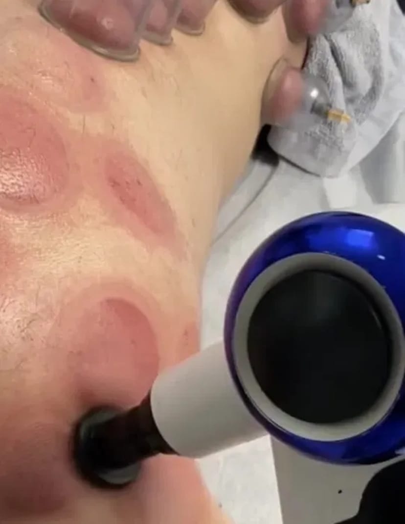 Масажист. Хороший масаж - загальний, релакс, спортивний, урологічний та інші