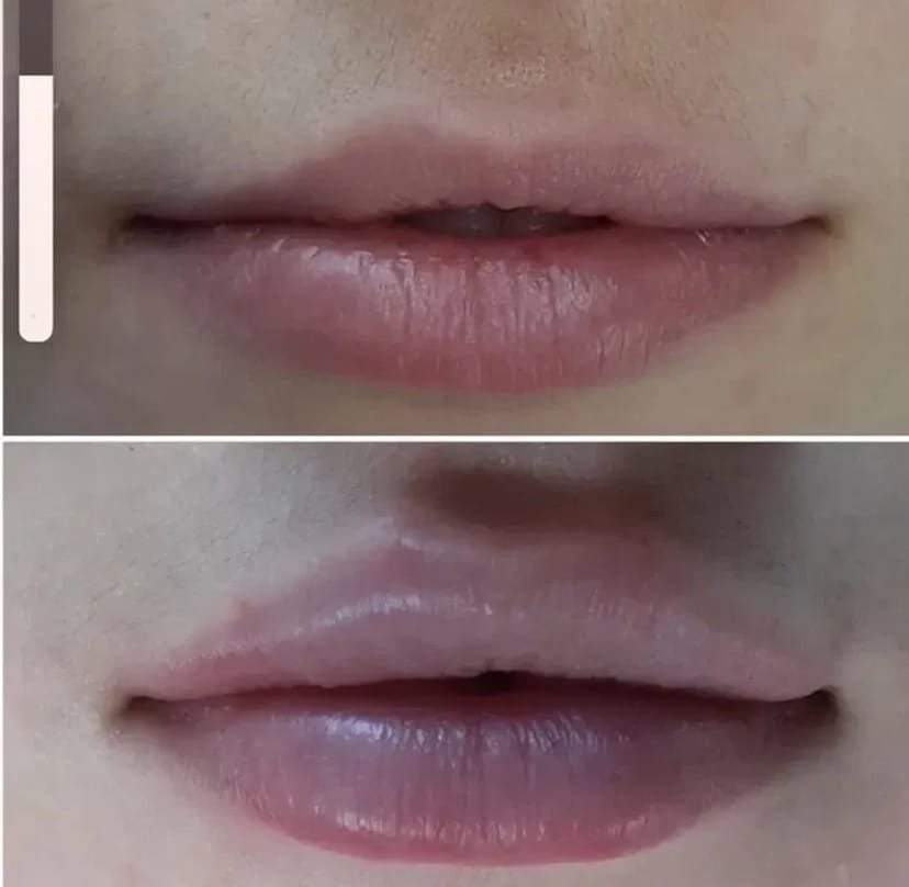 Масаж косметологія ліфтинг кавітація