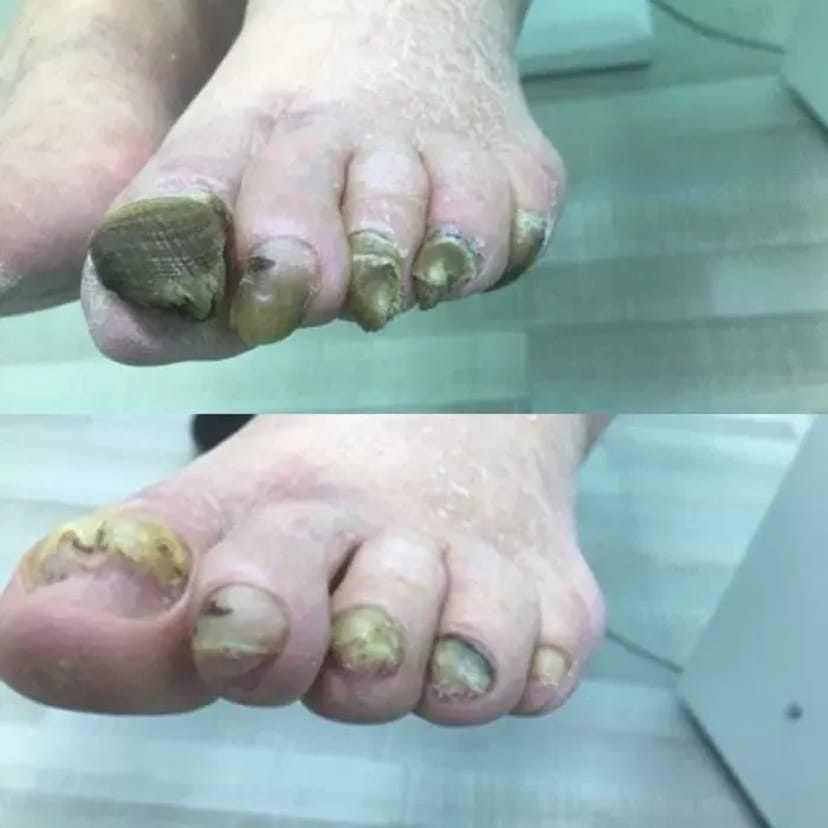 Педікюр подолог виізд