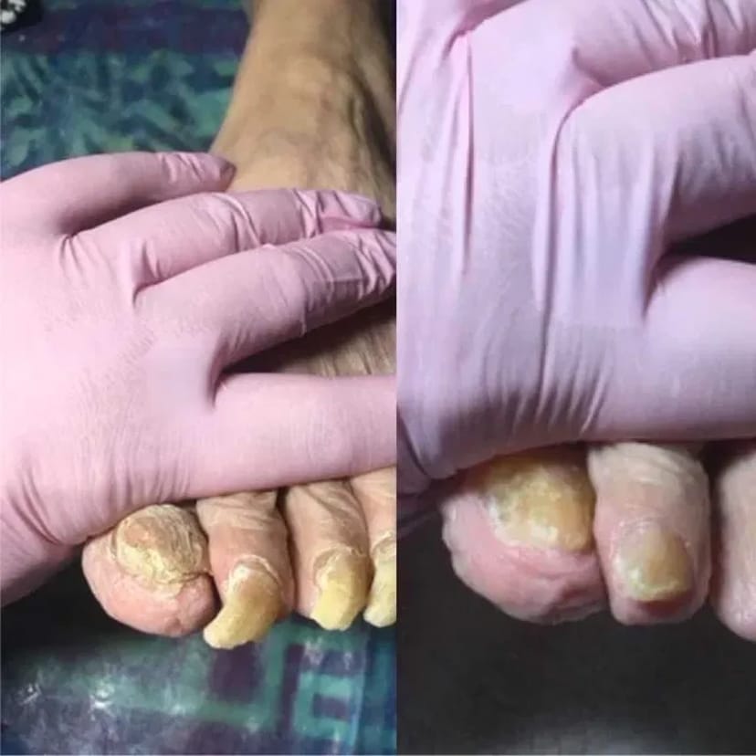 Педікюр подолог виізд