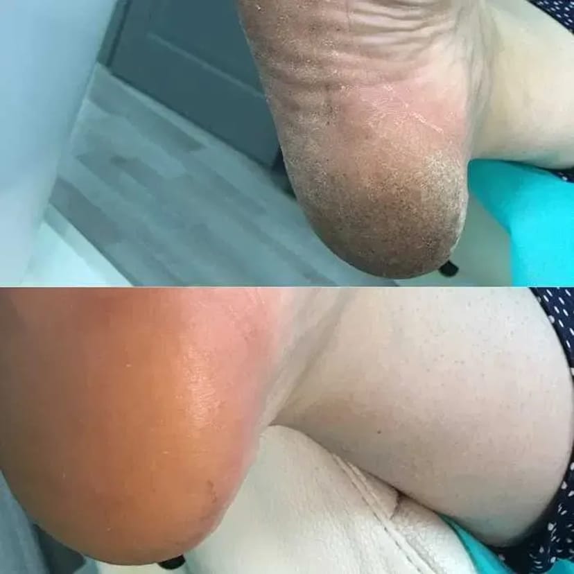 Педікюр подолог виізд