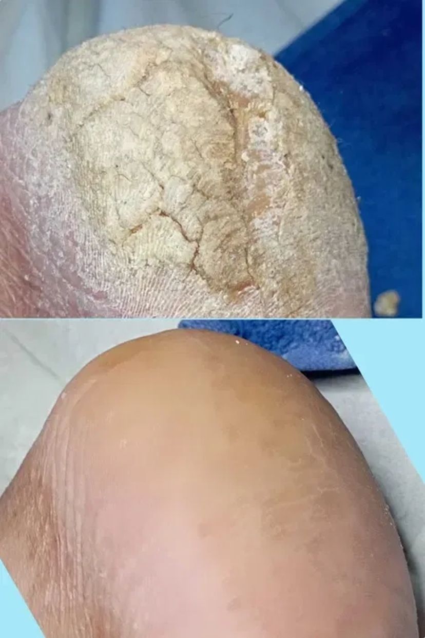 Педікюр подолог виізд