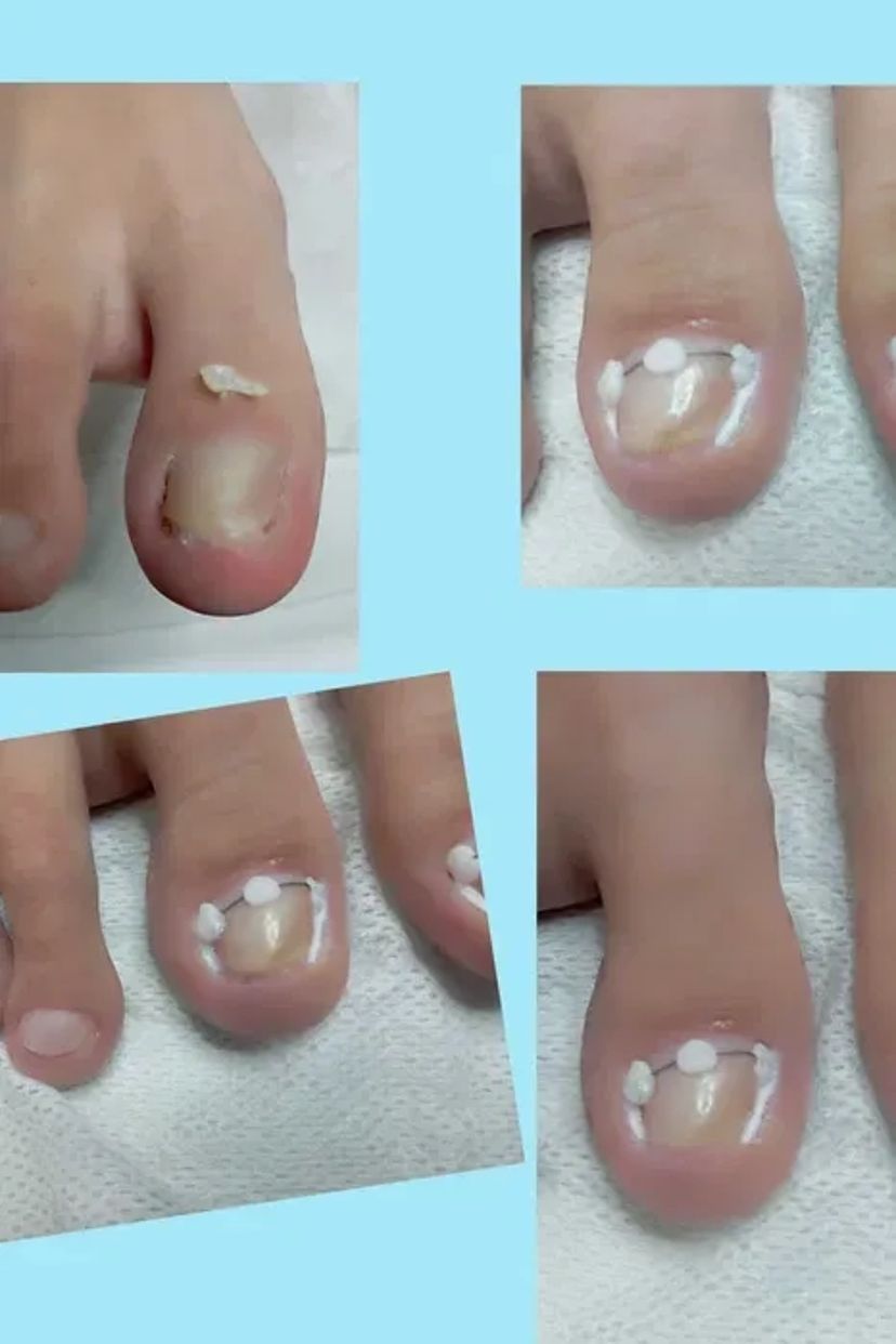 Педікюр подолог виізд