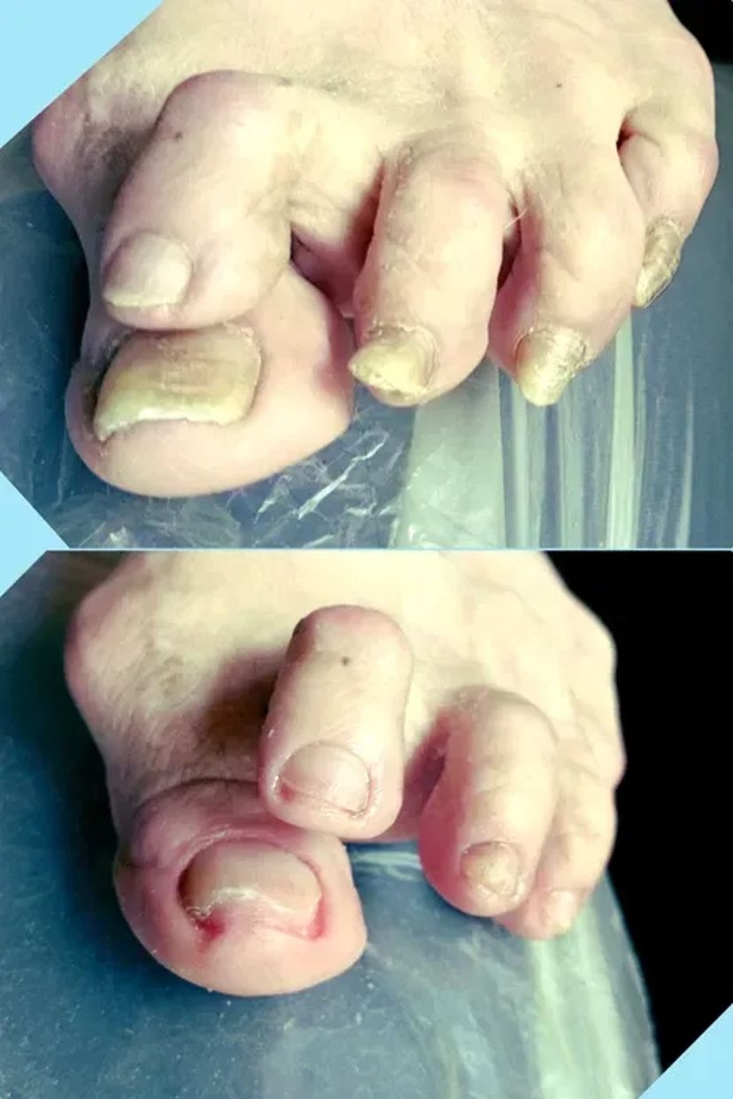 Педікюр подолог виізд