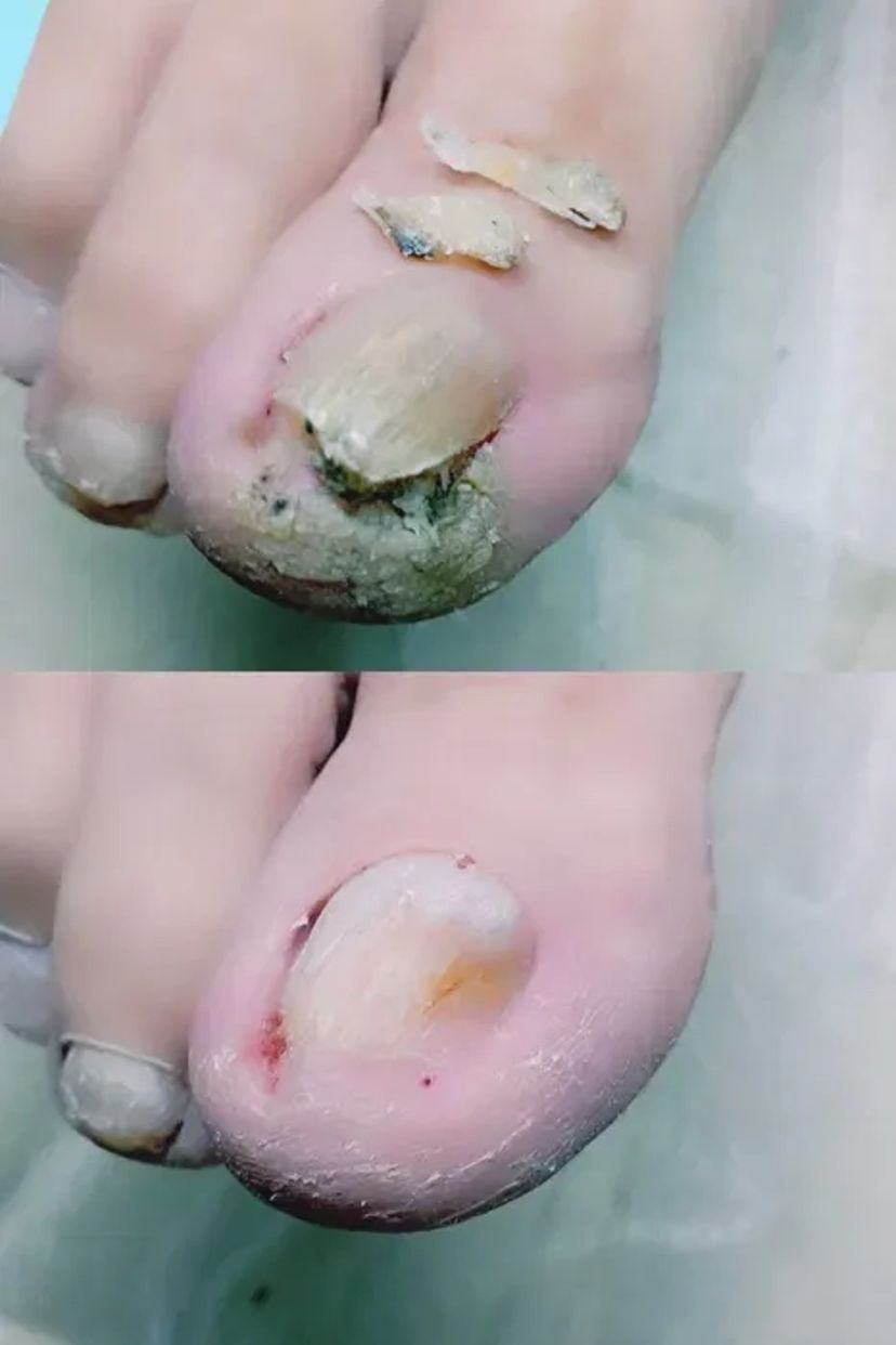 Педікюр подолог виізд