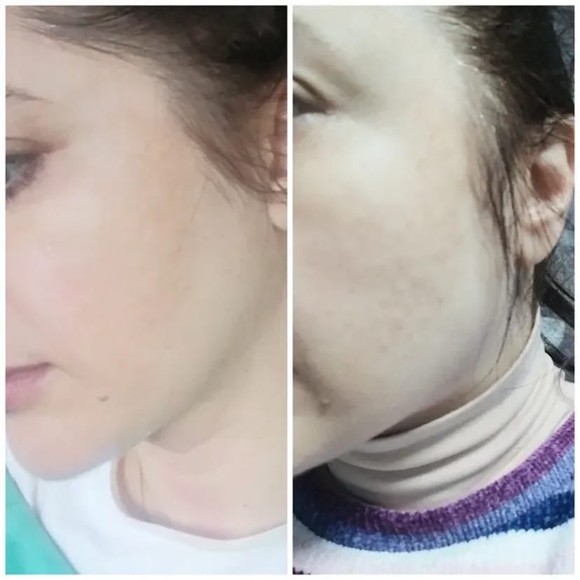 Косметолог+ подарок . Масаж обличчя, шиї, декольте