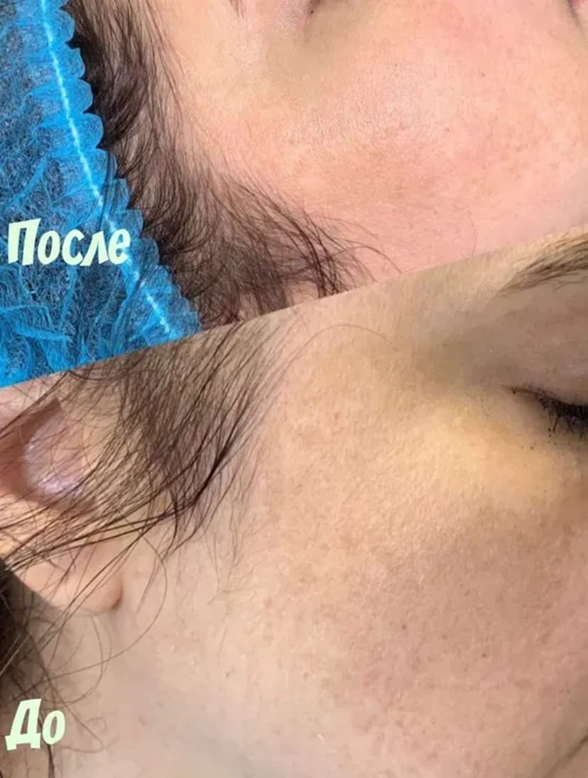 Косметолог+ подарок . Масаж обличчя, шиї, декольте