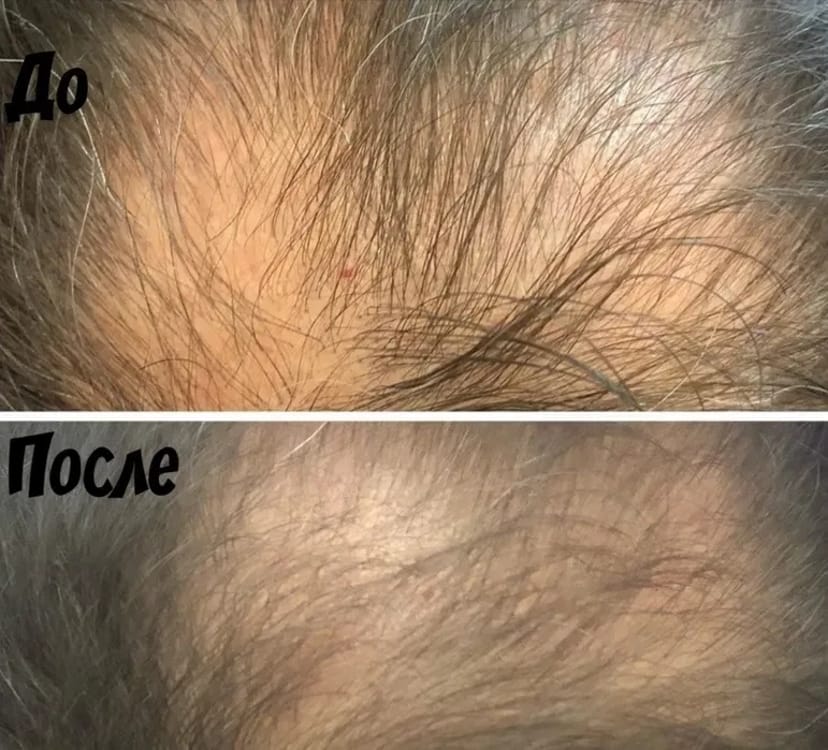 Косметолог+ подарок . Масаж обличчя, шиї, декольте