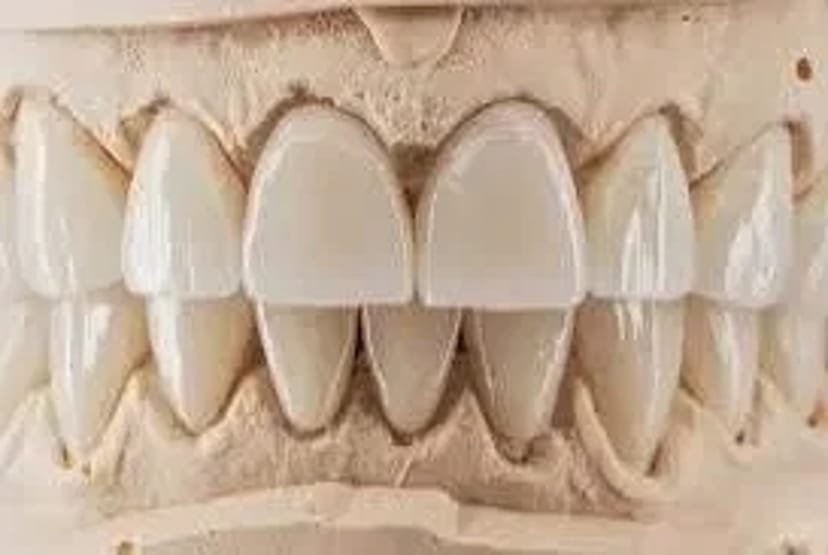 Зубний технік з досвідом: естетика, точність, результат