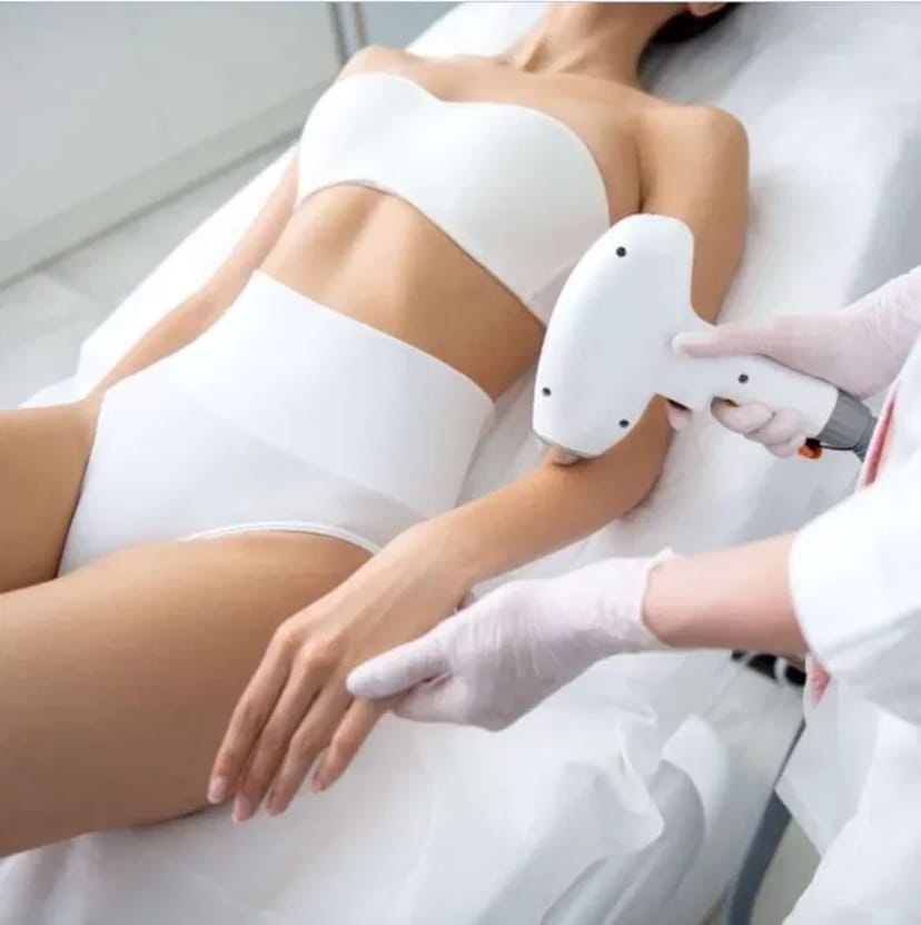 Лазерна епіляція: ідеально гладка шкіра без подразнень. Записуйтесь!