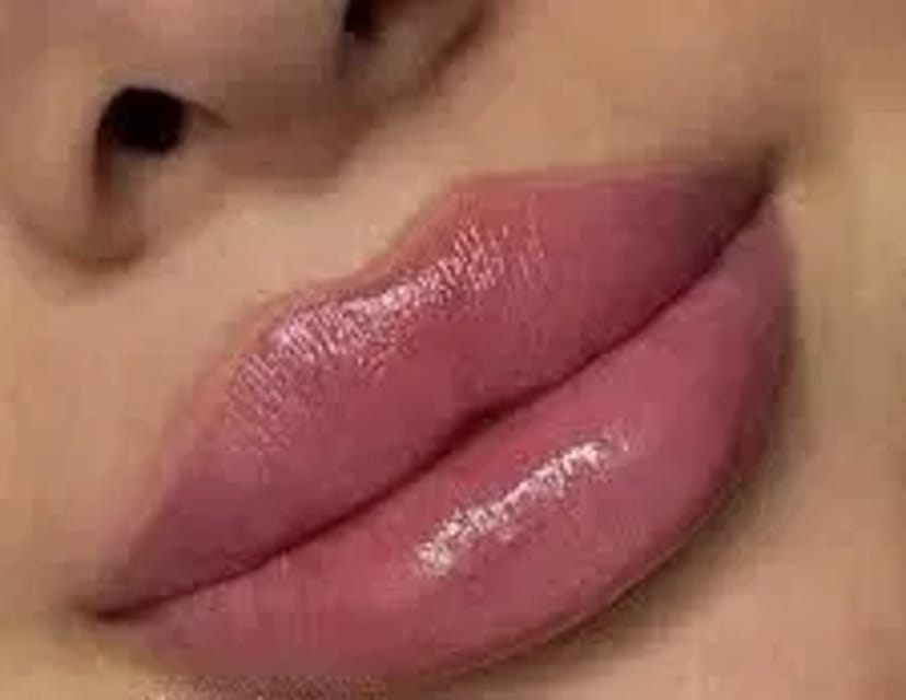 Косметологія, корекція збільшення Губ, Ботокс, Апаратний ліфтинг!