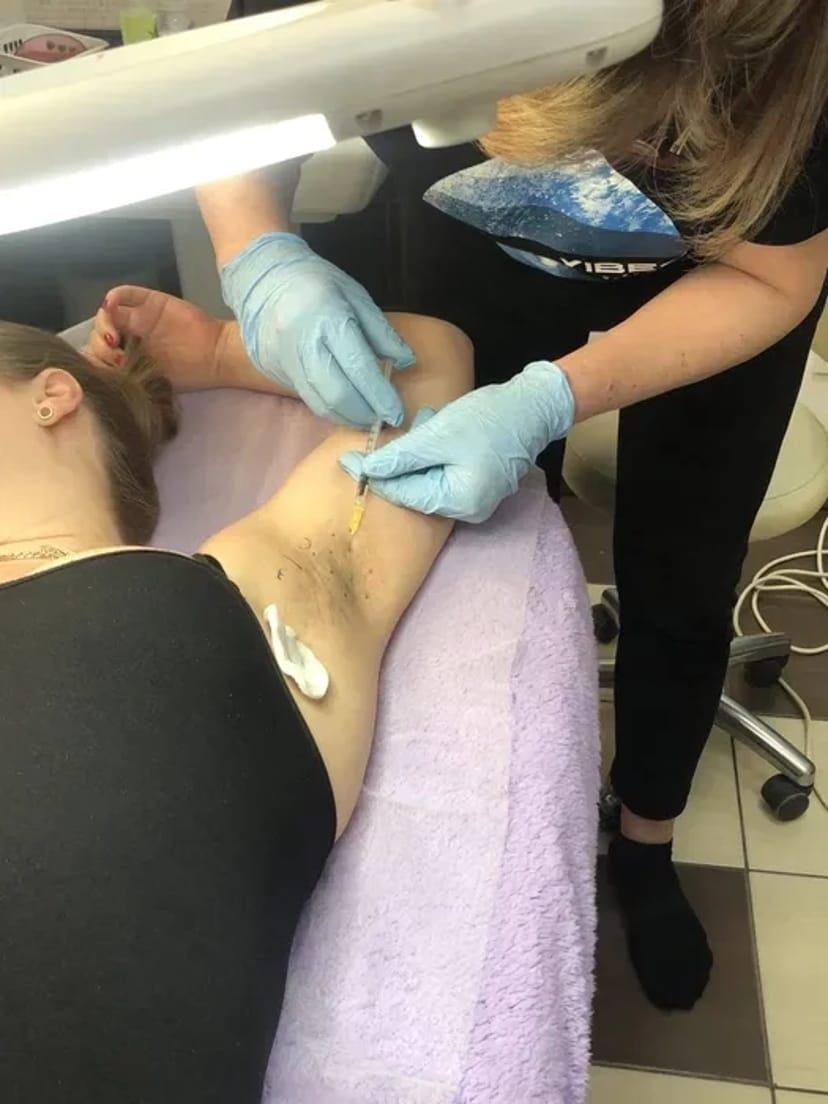 Навчання електроепіляції