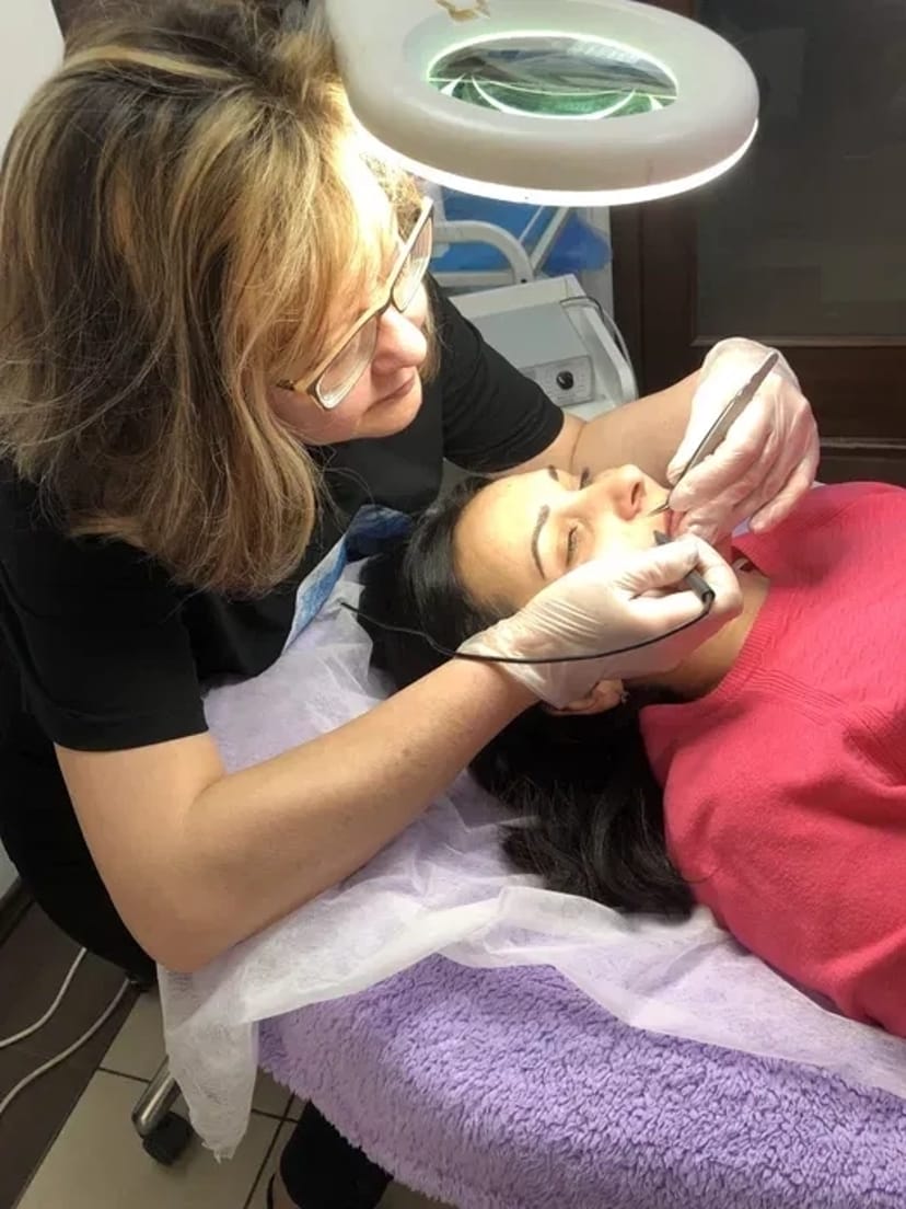 Навчання електроепіляції