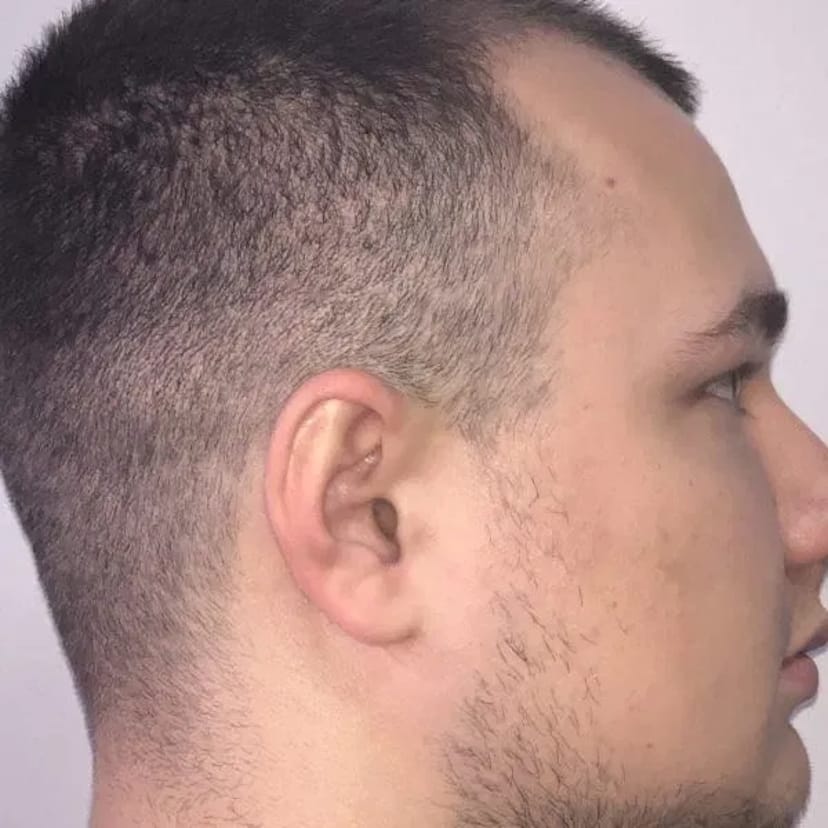 Мікронавушник Ужгород | Безпровідний комплект – 500 грн/день