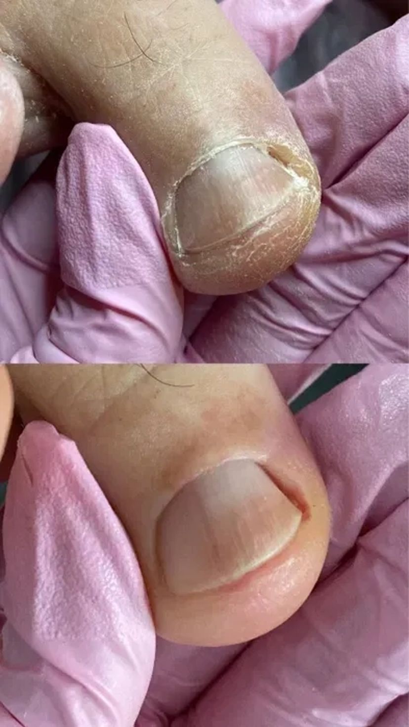 Курси манікюру ФРАНКІВСЬК | Підвищення | Педикюру | та нарощення