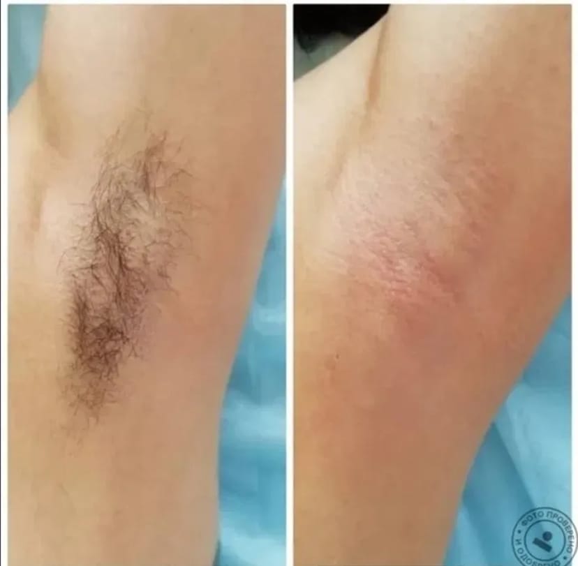 Майстер депіляції (віск, шугарінг), косметолог, масаж