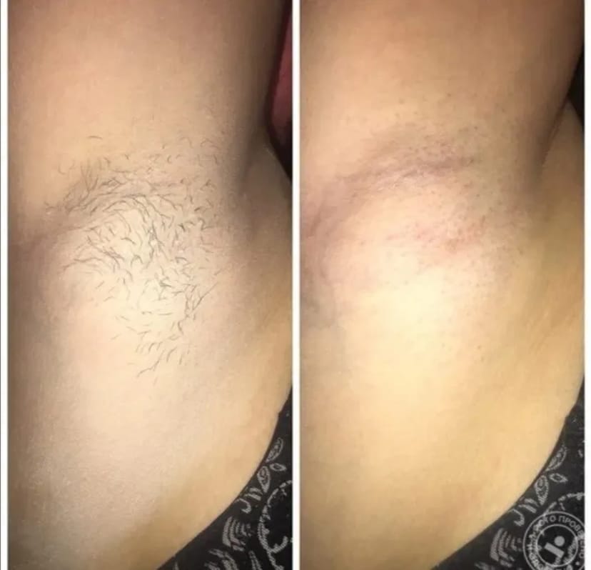 Майстер депіляції (віск, шугарінг), косметолог, масаж