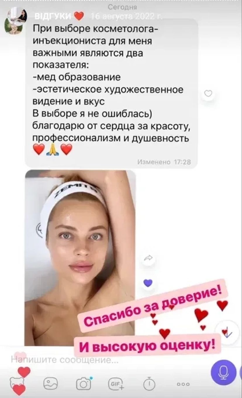 Ботокс, біоревіталізація. Супер АКЦІЯ 850 грн!