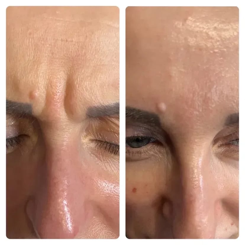 Косметолог очищення пілінг масаж кавітація пресотерапія депіляція