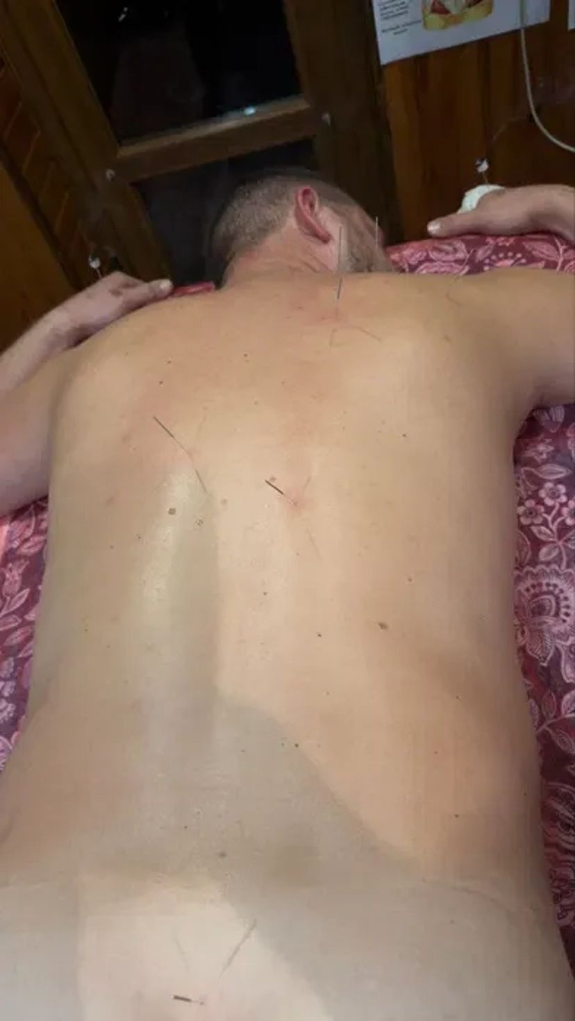 Массажист -иглоукалывание - реабилитолог на космосе